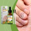 Houkea Nail Care Oil, Gentle Repair Soft, Thick, Hollow And Smooth Nail Polish